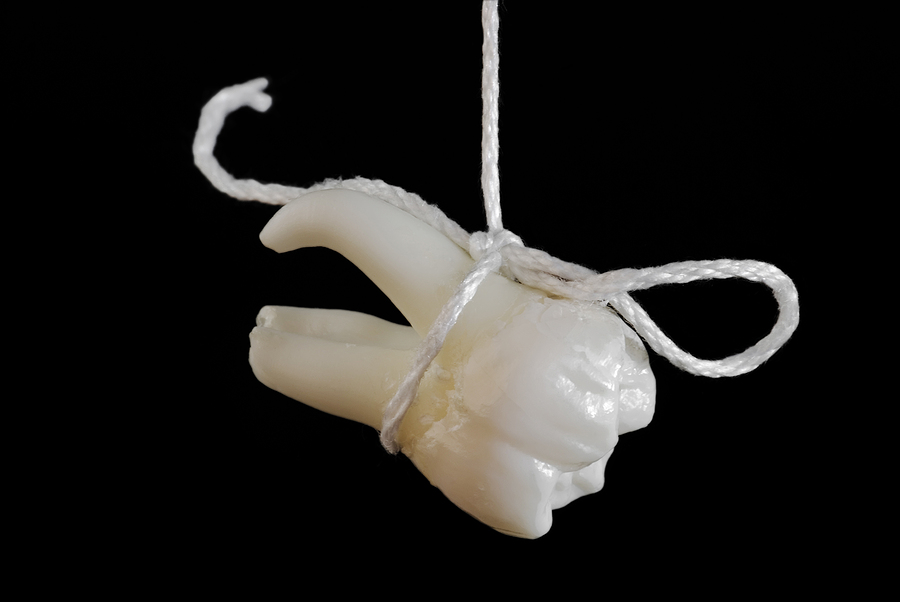 Dental Extractions for Orthodontic Purposes