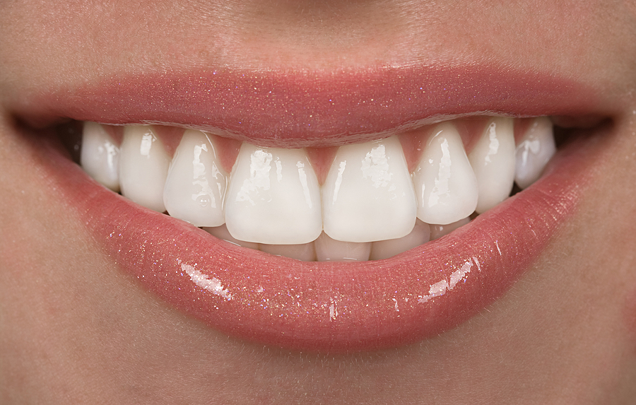 Transform Your Smile with Cosmetic Dentistry in Salt Lake, UT